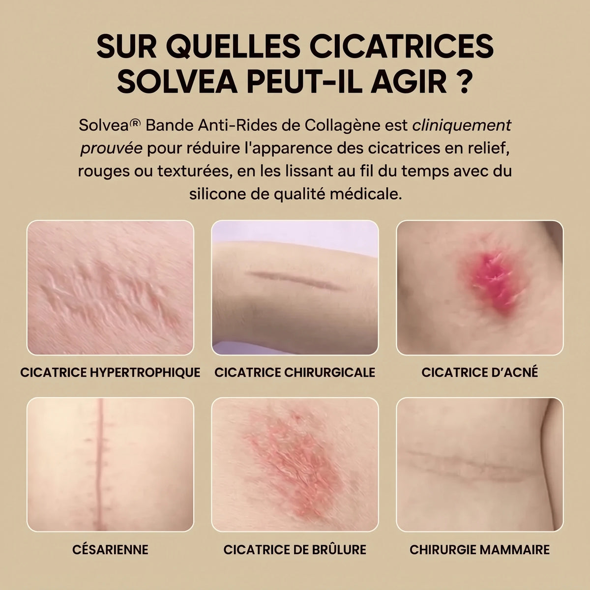 Solvea – Silicone Lift Patches