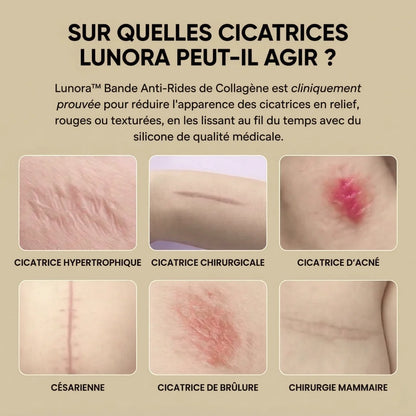 Lunora Lab™ – Silicone Lift Patches