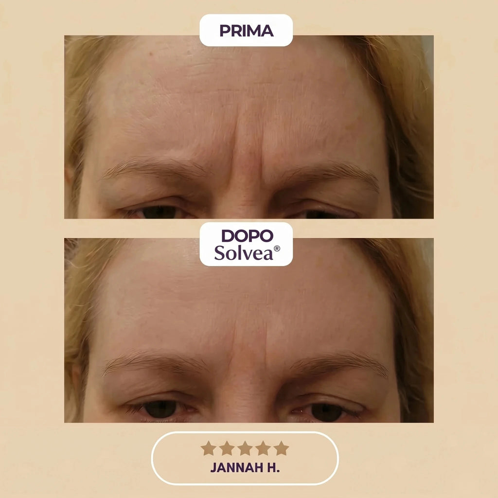 Solvéa – Silicone Lift Patches